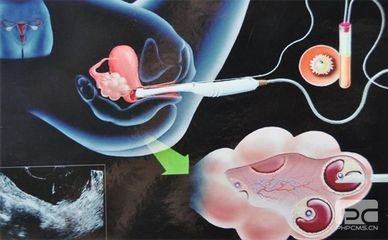 素竹生殖医学中心